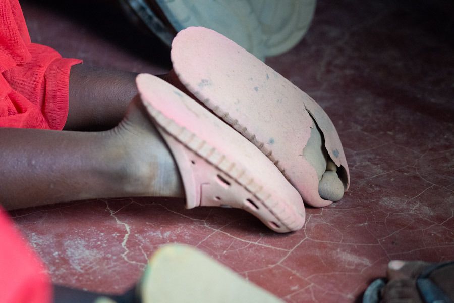 Schuhe werden getragen, bis gar nichts mehr geht. Diese Clogs müssen noch etwas durchhalten.
